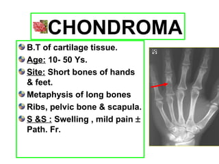Bone Tumors | PPT