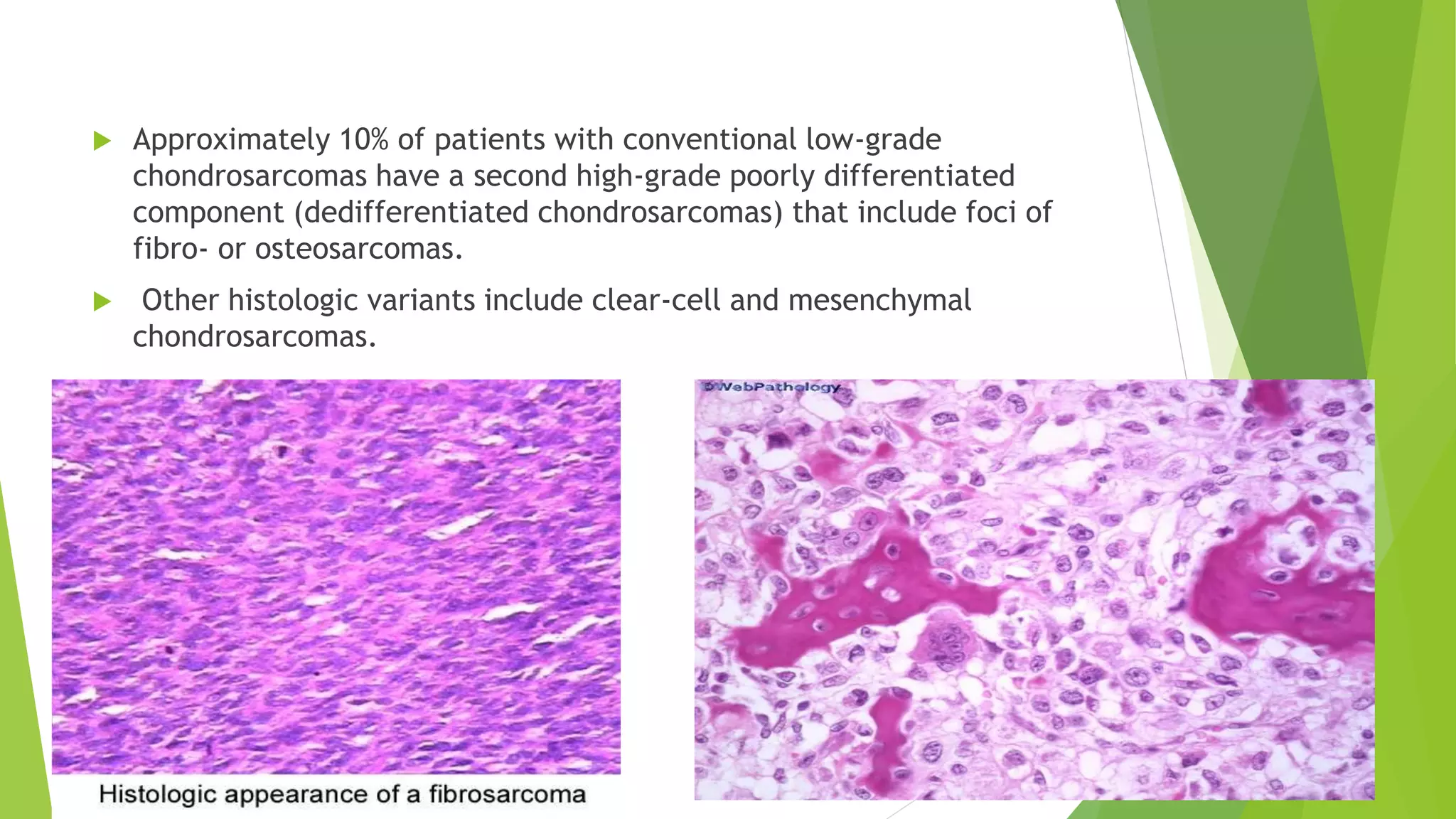  Approximately 10% of patients with conventional low-grade
chondrosarcomas have a second high-grade poorly differentiated
component (dedifferentiated chondrosarcomas) that include foci of
fibro- or osteosarcomas.
 Other histologic variants include clear-cell and mesenchymal
chondrosarcomas.
 