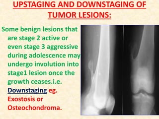 UPSTAGING AND DOWNSTAGING OF
TUMOR LESIONS:
Some benign lesions that
are stage 2 active or
even stage 3 aggressive
during adolescence may
undergo involution into
stage1 lesion once the
growth ceases.i.e.
Downstaging eg.
Exostosis or
Osteochondroma.
 