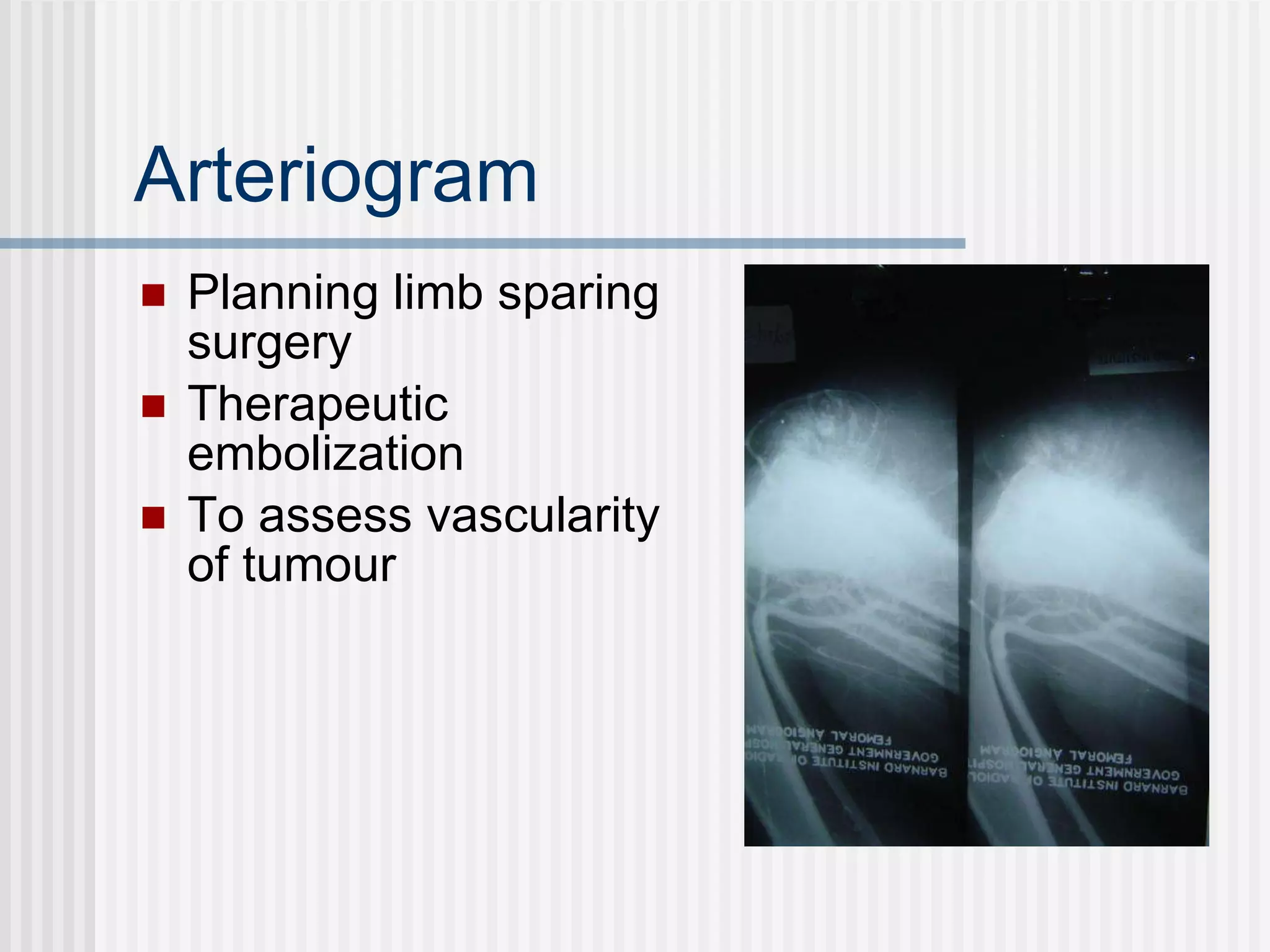 Arteriogram Planning limb sparing surgery Therapeutic embolization To assess vascularity of tumour 
