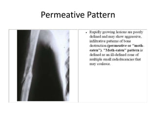 Permeative Pattern
 