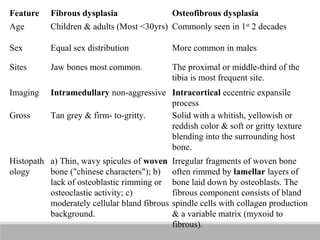 Wavy Tibia Bone tumours | PPT