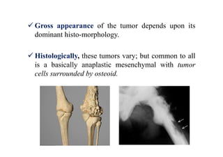 Bone tumours (compiled by Dr. Sanjib Kumar Das) | PDF