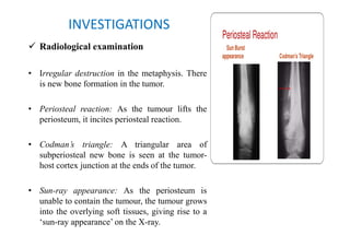 Bone tumours (compiled by Dr. Sanjib Kumar Das) | PDF
