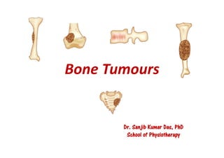 Bone Tumours
Dr. Sanjib Kumar Das, PhD
School of Physiotherapy
 