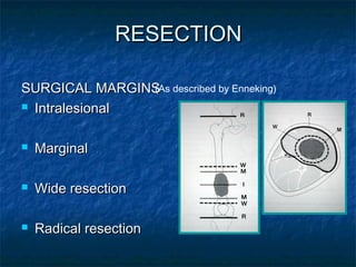 Bone tumours and principles of limb salvage surgery | PPT