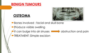 Classification of bone tumours and benign tumours of bone.pptx