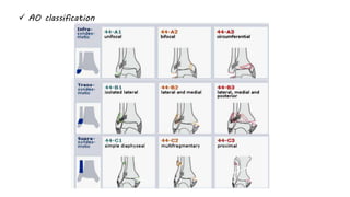  AO classification
 