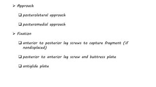  Approach
 posterolateral approach
 posteromedial approach
 Fixation
 anterior to posterior lag screws to capture fragment (if
nondisplaced)
 posterior to anterior lag screw and buttress plate
 antiglide plate
 