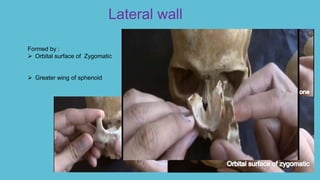 Lateral wall
Formed by :
 Orbital surface of Zygomatic
 Greater wing of sphenoid
 