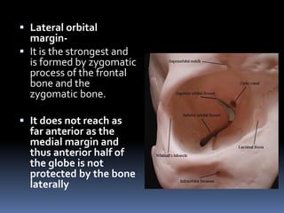  Lateral orbital
margin-
 It is the strongest and
is formed by zygomatic
process of the frontal
bone and the
zygomatic bone.
 It does not reach as
far anterior as the
medial margin and
thus anterior half of
the globe is not
protected by the bone
laterally
 