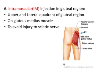 6. Intramuscular(IM) injection in gluteal region:
• Upper and Lateral quadrant of gluteal region
• On gluteus medius muscle
• To avoid injury to sciatic nerve.
 