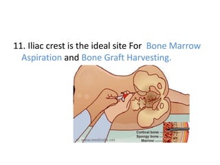 11. Iliac crest is the ideal site For Bone Marrow
Aspiration and Bone Graft Harvesting.
 