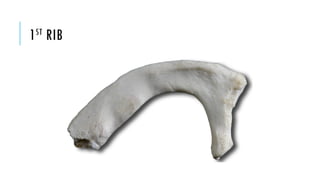 First Rib Manip Bony_thorax updated.pptx anatomy presentation. | PPTX