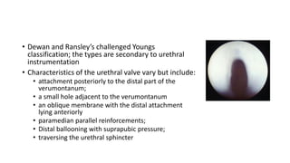 • Dewan and Ransley’s challenged Youngs
classification; the types are secondary to urethral
instrumentation
• Characteristics of the urethral valve vary but include:
• attachment posteriorly to the distal part of the
verumontanum;
• a small hole adjacent to the verumontanum
• an oblique membrane with the distal attachment
lying anteriorly
• paramedian parallel reinforcements;
• Distal ballooning with suprapubic pressure;
• traversing the urethral sphincter
 