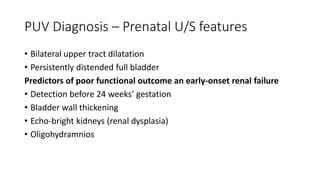 PUV Diagnosis – Prenatal U/S features
• Bilateral upper tract dilatation
• Persistently distended full bladder
Predictors of poor functional outcome an early-onset renal failure
• Detection before 24 weeks’ gestation
• Bladder wall thickening
• Echo-bright kidneys (renal dysplasia)
• Oligohydramnios
 