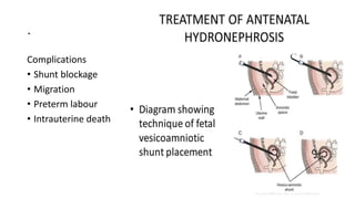 .
Complications
• Shunt blockage
• Migration
• Preterm labour
• Intrauterine death
 