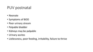PUV postnatal
• Neonate
• Symptoms of BOO
• Poor urinary stream
• Palpable bladder
• Kidneys may be palpable
• Urinary ascites
• Listlessness, poor feeding, irritability, failure to thrive
 