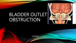 BLADDER OUTLET
OBSTRUCTION
Dr.KENZU
1
 