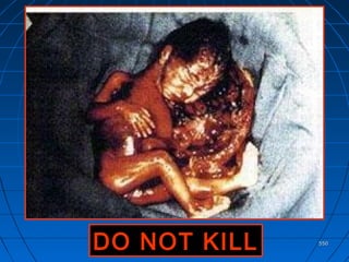 550550
DO NOT KILLDO NOT KILL
 