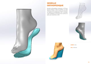 10
ANNÉE : 2016
LIEU : leFabClub
SEMELLE
ORTHOPEDIQUE
Semelle orthopédique imprimée en 3D par
Océane Delain à l’aide de FilaFlex. Le pied
d’Océane à été scanné en 3D, puis retouché
sur logiciel de modélisation 3D. La semelle
à été modélisée en fonction des courbes du
pied, puis imprimée en 3D.
 