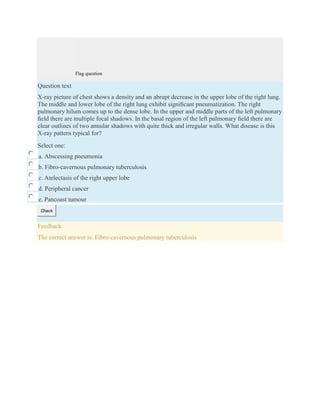 Flag question
Question text
X-ray picture of chest shows a density and an abrupt decrease in the upper lobe of the right lung.
The middle and lower lobe of the right lung exhibit signiﬁcant pneumatization. The right
pulmonary hilum comes up to the dense lobe. In the upper and middle parts of the left pulmonary
ﬁeld there are multiple focal shadows. In the basal region of the left pulmonary ﬁeld there are
clear outlines of two annular shadows with quite thick and irregular walls. What disease is this
X-ray pattern typical for?
Select one:
a. Abscessing pneumonia
b. Fibro-cavernous pulmonary tuberculosis
c. Atelectasis of the right upper lobe
d. Peripheral cancer
e. Pancoast tumour
Check
Feedback
The correct answer is: Fibro-cavernous pulmonary tuberculosis
 