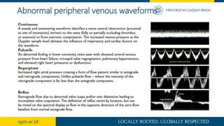 Abnormal peripheral venous waveforms
 
