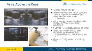 • “Mickey Mouse Image”
• Determine source of reflux colour or
spectral doppler, can be elicited
using Valsalva manouvre/
compression
• In transverse, determine destination
of reflux (GSV or major thigh
tributaries)
• If GSV Ø ↑ , suspect a source of reflux
• Follow full length of GSV and
tributaries to the knee. Test
compressibility and reflux every few
cm
• Measure Ø at junction and along
GSV
Veins Above the Knee
Myers K, Clough A. Making Sense of Vascular Ultrasound. 2004
 