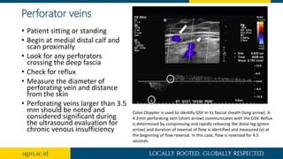 Perforator veins
• Patient sitting or standing
• Begin at medial distal calf and
scan proximally
• Look for any perforators
crossing the deep fascia
• Check for reflux
• Measure the diameter of
perforating vein and distance
from the skin
• Perforating veins larger than 3.5
mm should be noted and
considered significant during
the ultrasound evaluation for
chronic venous insufficiency
Color-Doppler is used to identify GSV in its fascial sheath (long arrow). A
4.2mm perforating vein (short arrow) communicates with the GSV. Reflux
is determined by compressing and rapidly releasing the distal leg (green
arrow) and duration of reversal of flow is identified and measured (x) at
the beginning of flow reversal. In this case, flow is reversed for 4.5
seconds.
 