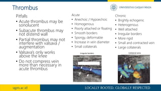 Acute
• Anechoic / Hypoechoic
• Homogenous
• Poorly attached or floating
• Smooth borders
• Spongy, deformable
• Increase in vein diameter
• Small collaterals
Chronic
• Brightly echogenic
• Heterogenous
• Well attached
• Irregular borders
• More rigid
• Small and contracted vein
• Large collaterals
Thrombus
Irregular borders Collateral veins
Pitfalls
• Acute thrombus may be
sonolucent
• Subacute thrombus may
not distend wall
• Partial thrombus may not
interfere with valsava /
augmentation
• Valsava’s only works
above the knee
• Do not compress vein
more than necessary in
acute thrombus
 