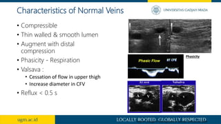 • Compressible
• Thin walled & smooth lumen
• Augment with distal
compression
• Phasicity - Respiration
• Valsava :
• Cessation of flow in upper thigh
• Increase diameter in CFV
• Reflux < 0.5 s
Characteristics of Normal Veins
Myers K, Clough A. Making Sense of Vascular Ultrasound. 2004
Phasicity
 