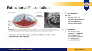 Chorionic Ridge Book Reading Williams Obstetric Chapther 6 - Placental Abnormalities.pptx
