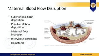Subchorionic Infarct Book Reading Williams Obstetric Chapther 6 - Placental Abnormalities.pptx