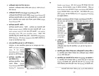 †ejyb GbwRIcøvwó wK ?
†ejyb GbwRI cøvwó GK ai‡bi nv‡U©i i³bvjxi AvaywbK wPwKrmv †hLv‡b
i³bvjx‡Z eøK n‡j Zv †ejyb w`‡q dzwj‡q eøK `yi Kiv hvq ev eø‡Ki
gvÎv Kgv‡bv nq|
 