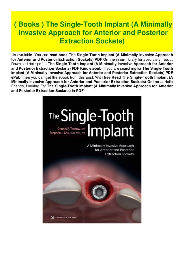 ( Books ) The SingleTooth Implant (A Minimally Invasive Approach for