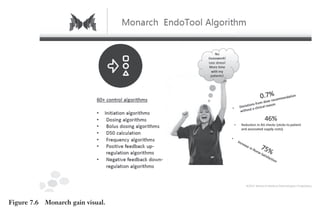 Trim
Size:
6in
x
9in
Morin
c07.tex
V1
-
07/25/2018
5:59pm
Page
157
k
k
k
k
157
Figure 7.6 Monarch gain visual.
 