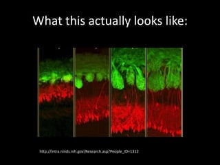 What this actually looks like:
http://intra.ninds.nih.gov/Research.asp?People_ID=1312
 