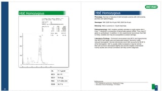 Hb 11.1 gm/dl
MCV 63.1 fl
MCH 19.9 pg
RBC 5.7 mill/c.mm
RDW 16.7 %
25
HbE Homozygous
****Beta Thal Short 30100-A ****
DATE :08/10/05 TIME:31:12:41
TECH ID # 0
VIAL # 65
SAMPLE ID # 00000000000003819565
ANALYTE ID % TIME AREA
F 2.5 1.12 56895
P3 4.6 1.76 103440
AO 3.4 2.28 76818
A2 84.9 3.68 1734019
TOTAL AREA 1971172
F 2.5% A2 84.9%
30%
20%
10%
0
0 1 2 3 4 5 6
HbE Homozygous
Phenotype: Normal or features of mild hemolytic anemia with mild anemia,
jaundice and splenomegaly.
Genotype: HbE (ß26 GluLys)/ HbE (ß26 GluLys).
Ethnicity: HbE is common in South East Asia.
Pathophysiology: HbE mutation partially activates a cryptic splice site in
Exon 1, resulting in a proportion of abnormally spliced mRNA. Thus, less ßE
globin is synthesized. In addition, In vitro experiments have shown that HbE
is mildly unstable and may be susceptible to oxidant damage.
Laboratory Findings : Prominent microcytosis (low MCV) and hypochromia
(low MCH) with target cells and leptocytes present. Normal or mildly
reduced hemoglobin. Normal reticulocyte count.HbE accounts for 85-95 %
of the hemoglobin. HbF is usually mildly increased or may be normal.
Red cell survival is decreased slightly and osmotic fragility is decreased.
Family studies and clinical correlation will help confirm diagnosis.
References
• The Thalassemia syndromes. Weatherall & Clegg.
• Wintrobes Clinical Hematology. 11th Edition
26
 