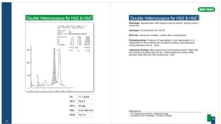 Hb 11.1 gm/dl
MCV 78.8 fl
MCH 25.5pg
RBC 4.34 mill/c.mm
RDW 14.2 %
37
Double Heterozygous for HbS & HbE
****Beta Thal Short 30100-A ****
DATE :20/07/05 TIME:10:56:31
TECH ID # 0
VIAL # 10
SAMPLE ID # 00000000000003468895
ANALYTE ID % TIME AREA
F 4.3 1.12 79762
P3 1.8 1.75 32664
A0 5.2 2.30 95269
A2 33.4 3.68 557750
S-WINDOW 53.9 4.48 992167
TOTAL AREA 1757612
30% F 4.3% A2 33.4%
20%
10%
0
0 1 2 3 4 5 6
Double Heterozygous for HbS & HbE
Phenotype: Asymptomatic. Mild anaemia may be present. Sickling crisis is
uncommon.
Genotype: Co-inheritance of ßs
and ßE
Ethnicity: Uncommon condition. Usually seen among Asians.
Pathophysiology: Presence of haemoglobin E and haemoglobin S is
responsible for mild anaemia and occasional sickling crisis particularly
during pregnancy and air travel.
Laboratory findings: Mild anaemia and microcytosis present. Target cells
are common but sickle cells are rare. Reticulocytes are usually mildly
elevated. Both HbS and HbE fractions are > 30%.
References
• The Thalassemia syndromes. Weatherall & Clegg.
• Wintrobes Clinical Hematology. 11th Edition Orphanet
38
 
