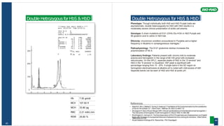 Hb 7.50 gm/dl
MCV 107.50 fl
MCH 33.80 pg
RBC 2.21 mill/c.mm
RDW 25.60 %
43
Double Hetrozygous forHbS & HbD
****Beta Thal Short 30100-A ****
DATE :02/07/05 TIME:14:43:11
TECH ID # 0
VIAL # 41
SAMPLE ID # 00000000000003468787
ANALYTE ID % TIME AREA
F 26.6 1.17 282682
AO 1.5 2.07 15370
Unknown 1 0.8 2.30 8839
Unknown 2 0.5 2.84 5222
A2 1.5 3.61 14728
D-WINDOW 39.5 4.12 414806
S-WINDOW 29.2 4.46 306448
30% TOTAL AREA 1048095
F 26.6% A2 1.5%
20%
10%
0
0 1 2 3 4 5 6
Double Hetrozygous for HbS & HbD
Phenotype: Though individually both HbS and HbD Punjab traits are
asymptomatic, double heterozygosity for HbD with HbS results in a
moderately severe clinical presentation of sickle cell anemia.
Genotype: ß chain mutations at ß121 (GH4) GluGln in HbD Punjab and
ß6 glutamic acid to valine in HbS trait.
Ethnicity: Uncommon condition encountered in Punjabis and a higher
frequency in Muslims in consanguineous marriages.*
Pathophysiology: The ß121 glutamine residue increases the
polymerization of Hb S.
Laboratory findings: Patients present with chronic mild to moderate
anemia and hemoglobin in the range of 60-100 gms/l with increased
reticulocytes. On the HPLC, separate peaks of HbD in the “D window” and
HbS in the “S window” is visualized. HbF peak is significant with
percentage ranging from 10 - 20%. A single band in the SD region on
hemoglobin electrophoresis at alkaline pH is noted with mild excess of HbF.
Separate bands can be seen of HbD and HbS at acidic pH.
References
• Adachi K, Kim J, BallasS, Surrey S,AsakuraT.Facilitationof Hb S polymerizationby the substitution
of Glu for Gln at ßeta 121. J Biol Chem. 1988Apr 25;263(12):5607-10.
• StrutegeonP,Itano HAand Bergen WR.Clinicalmanifestationsof inheritedabnormalhemoglobin.I
The interactionof hemoglobin-Swith hemoglobinD. Blood 1955;10:389-396
• WorthingtonS, Lehmann H.The first observationof Hb D Punjab beta zero thalassemiain an English
familywith 22 cases of unsuspectedbeta zero thalassemiaminor amongits members.J Med Genet.
1985;22(5):377-81.
* As perresearch findingsof Dr.Reena Das , PGI Chandigarh 44
 