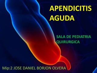 Mip:2 JOSE DANIEL BORJON OLVERA
APENDICITIS
AGUDA
SALA DE PEDIATRIA
QUIRURGICA
 