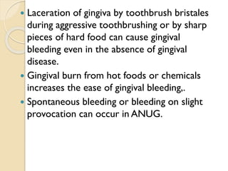  Laceration of gingiva by toothbrush bristales
during aggressive toothbrushing or by sharp
pieces of hard food can cause gingival
bleeding even in the absence of gingival
disease.
 Gingival burn from hot foods or chemicals
increases the ease of gingival bleeding,.
 Spontaneous bleeding or bleeding on slight
provocation can occur in ANUG.
 