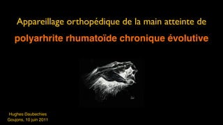 Appareillage orthopédique de la main atteinte de
   polyarhrite rhumatoïde chronique évolutive




Hughes Daubechies
Goujons, 10 juin 2011
 