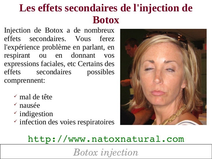 Boptox injection