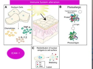 ICAM-1
Immune System alteration
 
