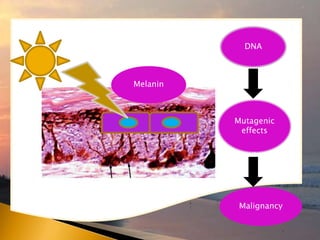 DNA
Mutagenic
effects
Malignancy
Melanin
 