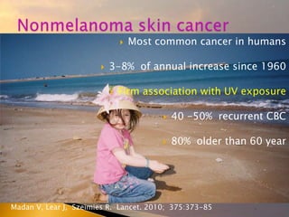  Most common cancer in humans
 3-8% of annual increase since 1960
 Firm association with UV exposure
 40 -50% recurrent CBC
 80% older than 60 year
Madan V, Lear J, Szeimies R. Lancet. 2010; 375:373-85
 