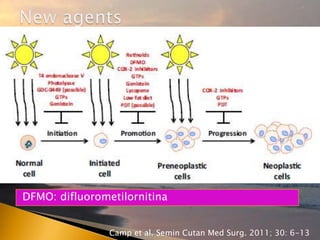 DFMO: difluorometilornitina
Camp et al. Semin Cutan Med Surg. 2011; 30: 6-13
 
