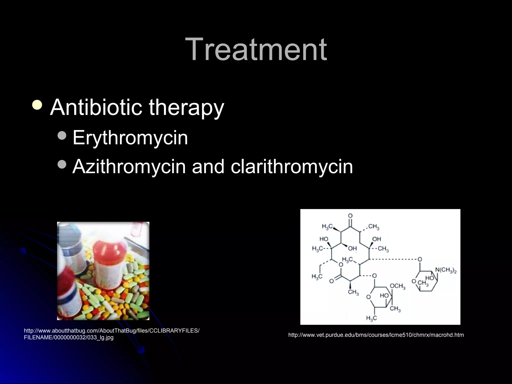 Treatment
   Antibiotic                             therapy
            Erythromycin
            Azithromycin                                  and clarithromycin




http://www.aboutthatbug.com/AboutThatBug/files/CCLIBRARYFILES/
FILENAME/0000000032/033_lg.jpg                                       http://www.vet.purdue.edu/bms/courses/lcme510/chmrx/macrohd.htm
 