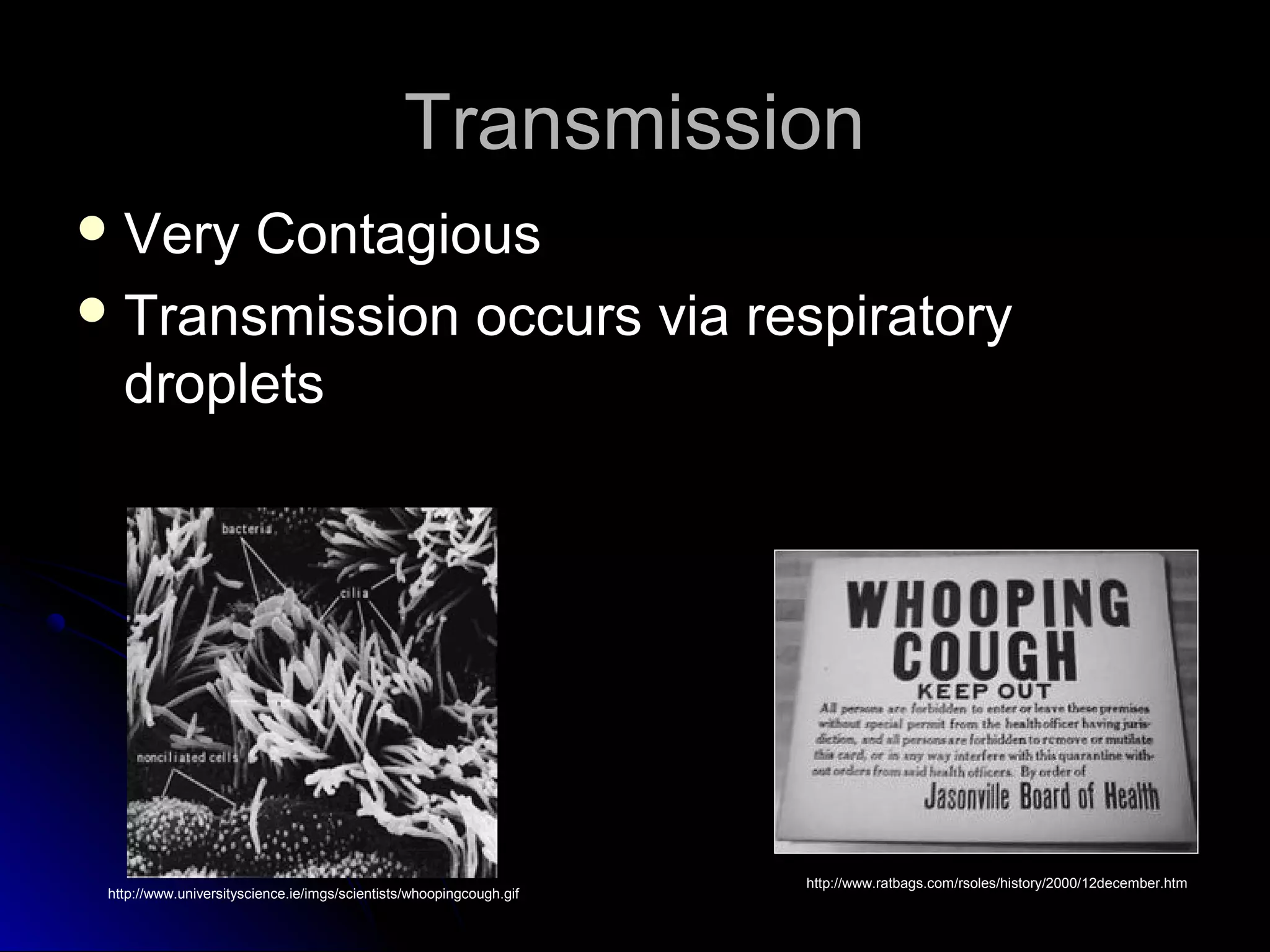 Transmission
 Very Contagious
 Transmission occurs via respiratory
  droplets




                                                                     http://www.ratbags.com/rsoles/history/2000/12december.htm
 http://www.universityscience.ie/imgs/scientists/whoopingcough.gif
 